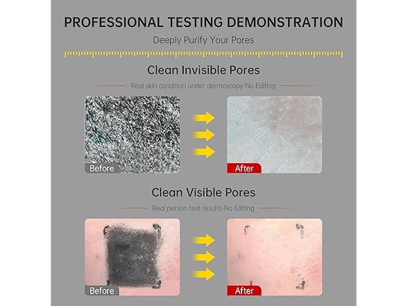 FLYLEAF BC2206625100001 Double Tube Face Wash