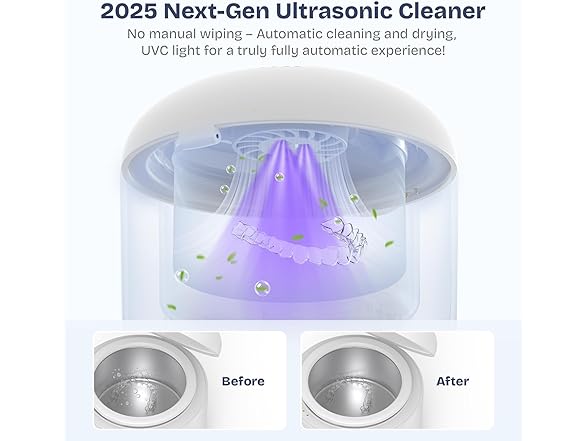 Newelkin Ultrasonic Retainer Cleaner