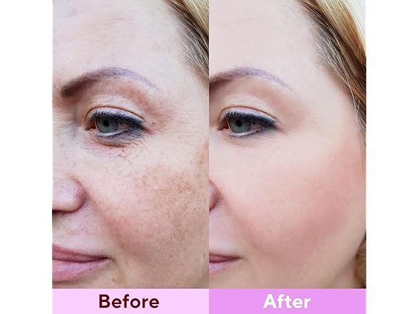 Nityrliv 4 Pack Collagen Face Mask