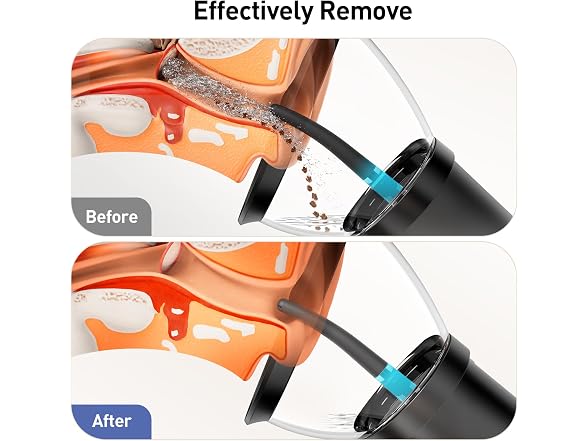 Ear Wax Removal Kit, Electric Ear
