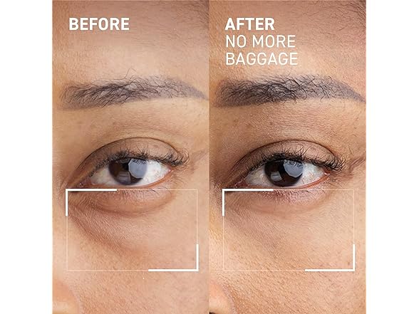 Dr. Brandt Needles No More, No More Baggage - 0.5 oz