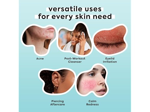 Hypochlorous Acid Spray for Face and Body