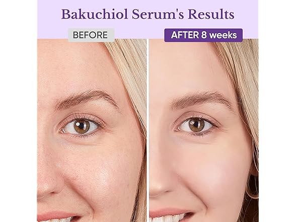 Bakuchiol Retinol Serum for Face