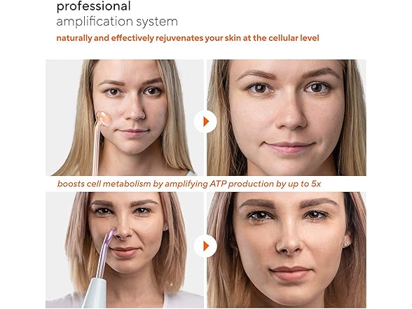 Professional Skin Therapy Wand Set