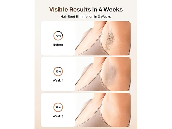 LYSMOSKI LYSMOSKI Laser Hair Removal with Cooling