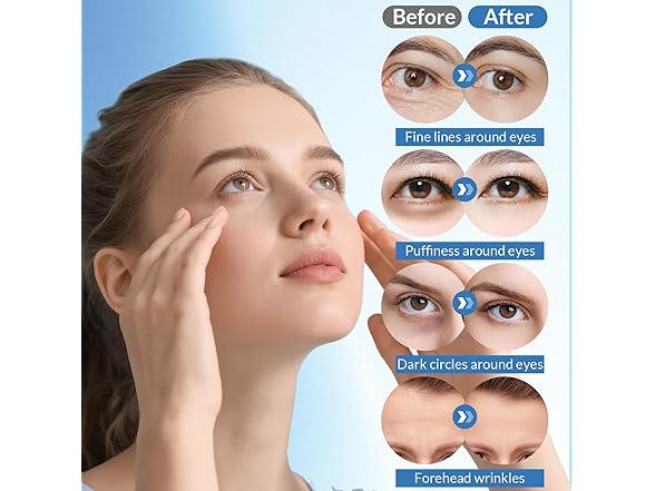 EclatMuse Forehead Wrinkle Patches