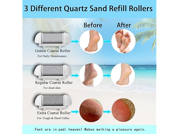 13-in-1 Electric Foot Callus Remover