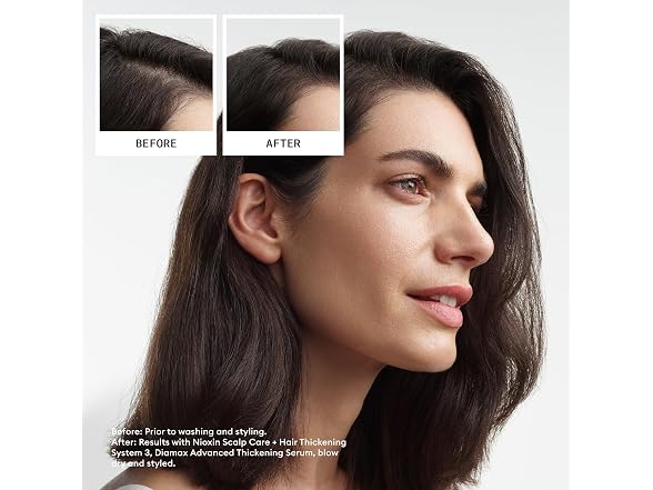 Nioxin System 3 Scalp + Hair Thickening Shampoo