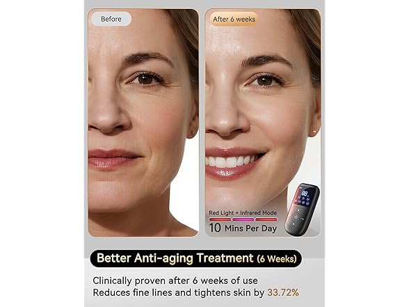 Sobetuar Red Light Therapy Face Mask