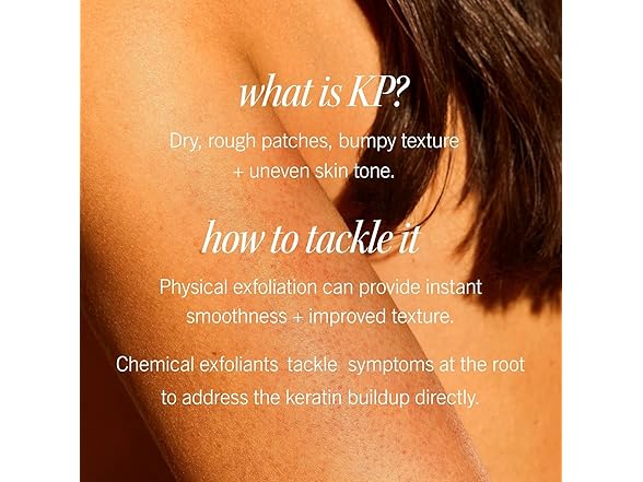 First Aid Beauty - KP Bump Eraser Body Scrub