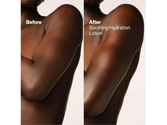 Suave Soothing Hydration Lotion 18oz