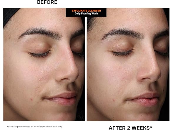 Kate Somerville ExfoliKate Cleanser