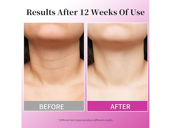 Mr Lilei 4 in 1 Retinol Moisturizer Cream