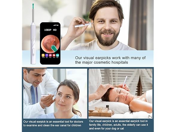 1080P HD Wifi Ear Cleaning Camera