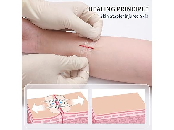 URAY  Emergency Wound Closure Device