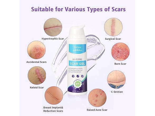Silicone Scar Gel Scar Cream | 1.7 oz