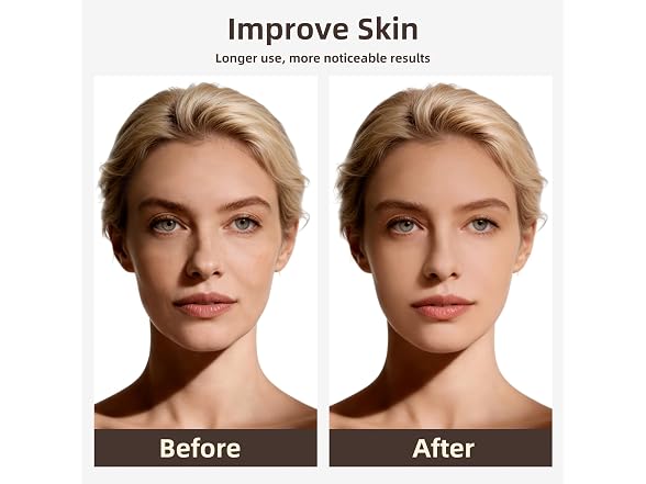 Red Light Therapy for Face – Red Light