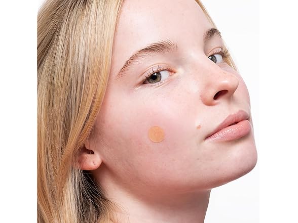 PEACE OUT Acne Healing Dots