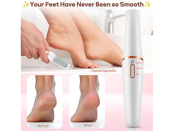 ZABOUL Electric Foot Callus Remover