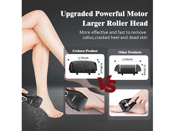 Crehora Electric Foot Callus Remover Kit
