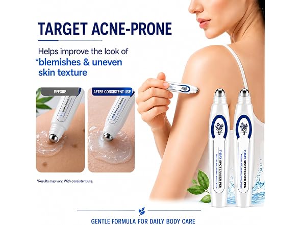 ASDF Cutra 7 Day Spot and Acne Remover