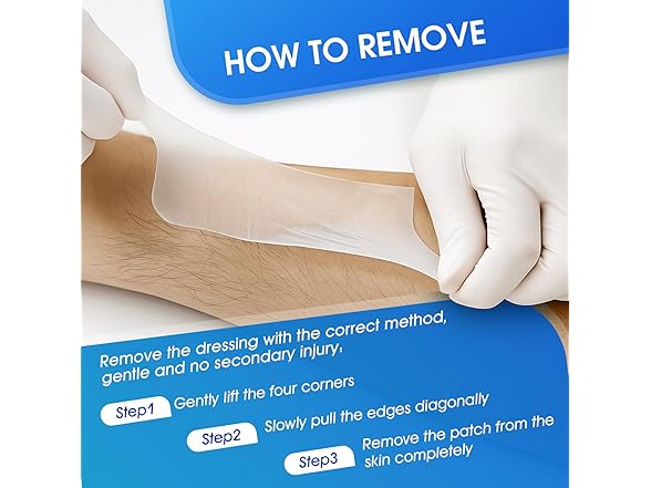 AKQFZHQ Hydrocolloid Roll for Wound Care