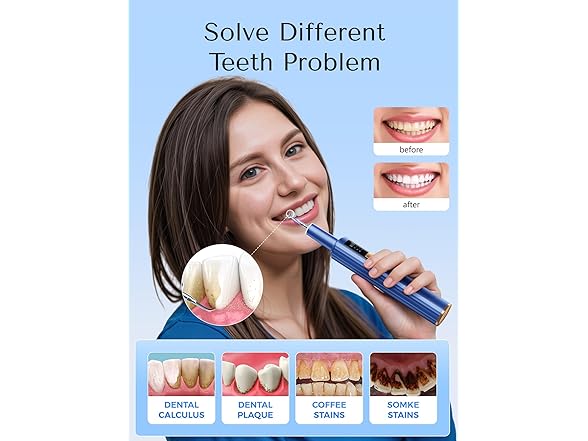 OXRMAK Plaque Remover for Teeth - Gallery 2