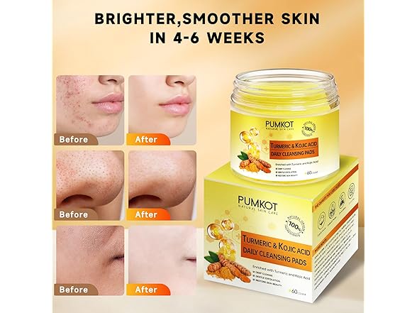 Pumkot Turmeric Kojic Acid Cleansing Pads