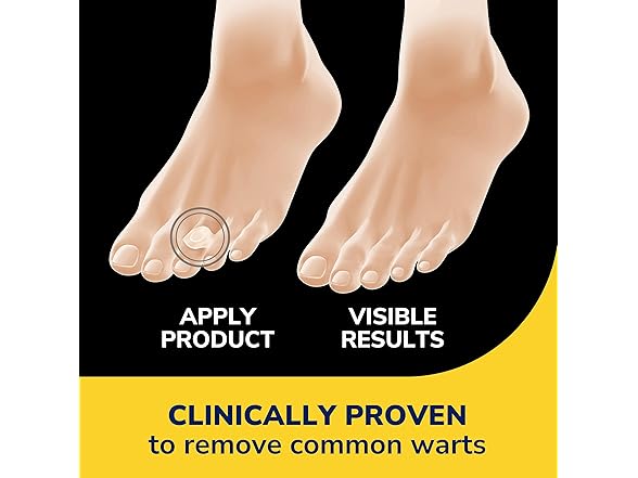 Dr. Scholl’s Clear Away Wart Remover Hydrogel Bandages for Fingers and Toes - Clinically Proven Effective Wart Removal and Cushioning Pain Relief, Comfortable Multi-Day Coverage Patches - Gallery 3