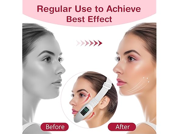 Electric Double Chin Reduces Device