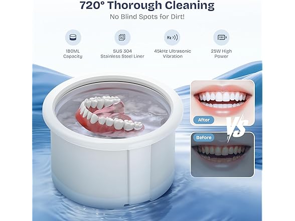 Newelkin Ultrasonic Retainer Cleaner