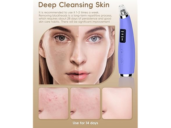 Facial Pore Blackhead Remover Vacuum