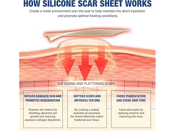 mitreal Silicone Scar Sheets