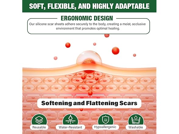 micakin Silicone Scar Tape 1.5M