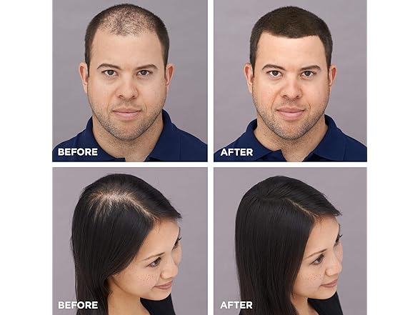 2PK Toppik Hair Building Fibers (Your Choice)