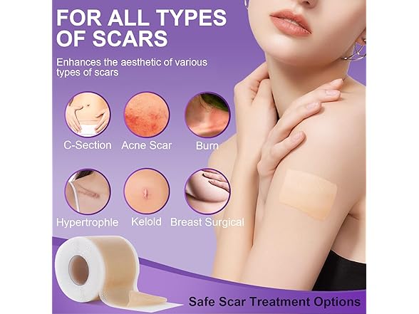 Mitgary Medical Grade Silicone Scar Tape