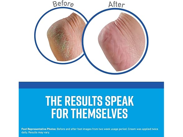 O'Keeffes 3 Oz Healthy Feet Foot Cream Tube