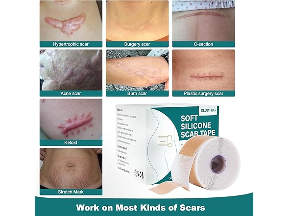SLUKHIG Silicone Scar Tape