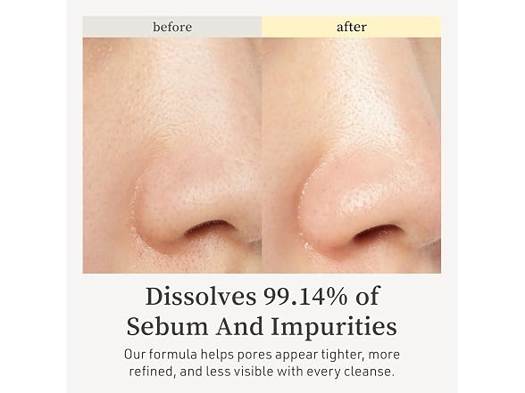NOONI Korean Cleansing Oil Snow Aqua 0 LHA Toning