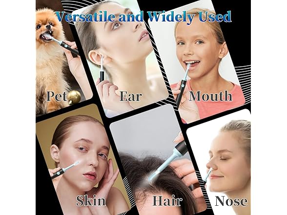 Wikups Ear Wax Removal