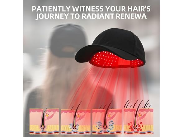 Carviki BC5385260162481 hair growth cap