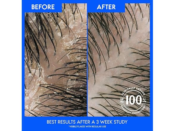 Head and Shoulders Smooth Silky 2in1 Twin Pack