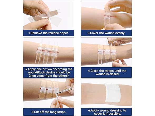 Emergency Wound Closure Device