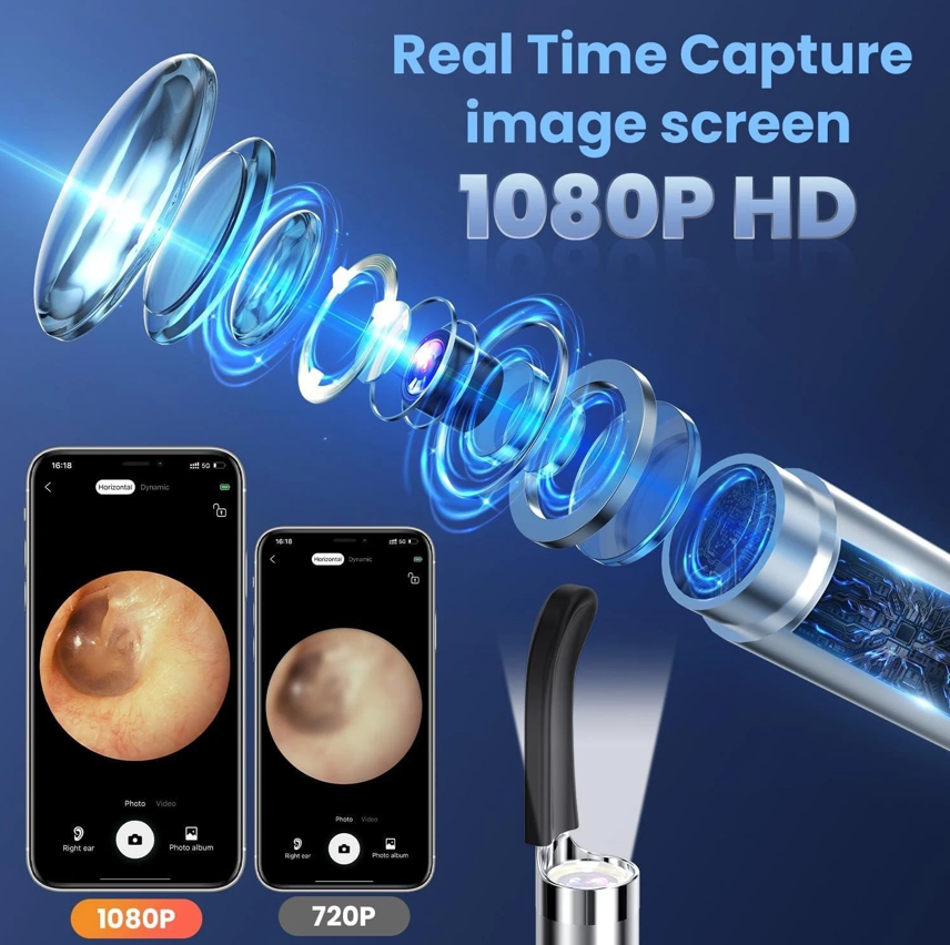 Ear Wax Removal 1080P Camera Tool - Gallery 11