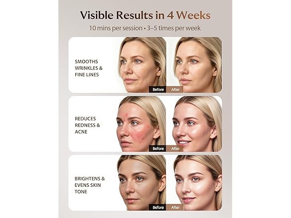 XSSNVV Red Light Therapy Mask