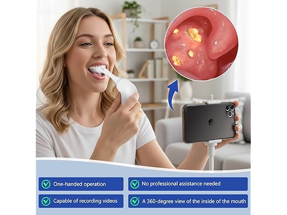 SIQIONG Electric Tonsil Stone Remover - Gallery 3