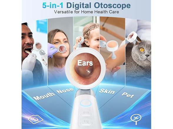 ASPOVEN 1080P HD Otoscope Ear Camera