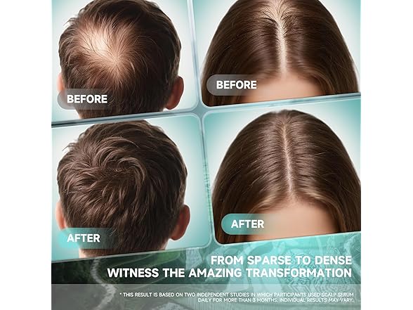 PRFTMK Hair Growth Serum