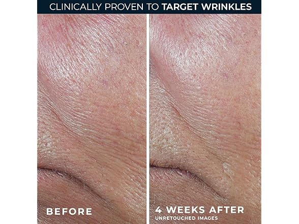 RoC | Derm Correxion Retinol 1.0 oz