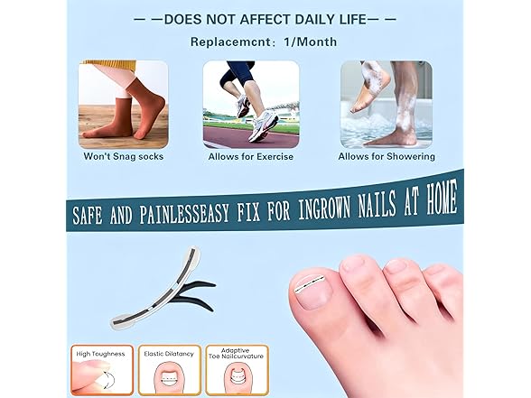 Ingrown Toenail Treatment